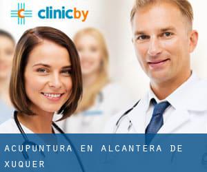 Acupuntura en Alcàntera de Xúquer